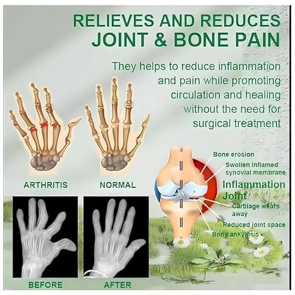 Bee Venom Joint and Bone Therapy Cream (Buy 1 Get 2 Free)