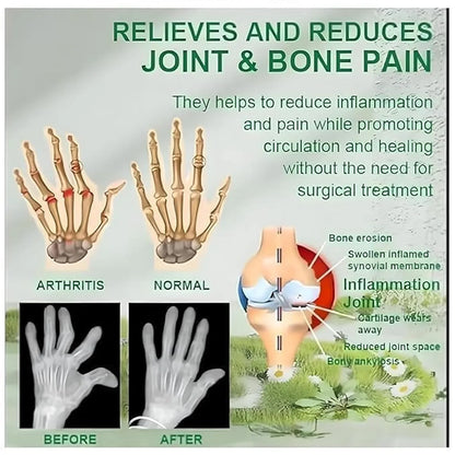 Bee Venom Joint and Bone Therapy Cream (Buy 1 Get 2 Free)